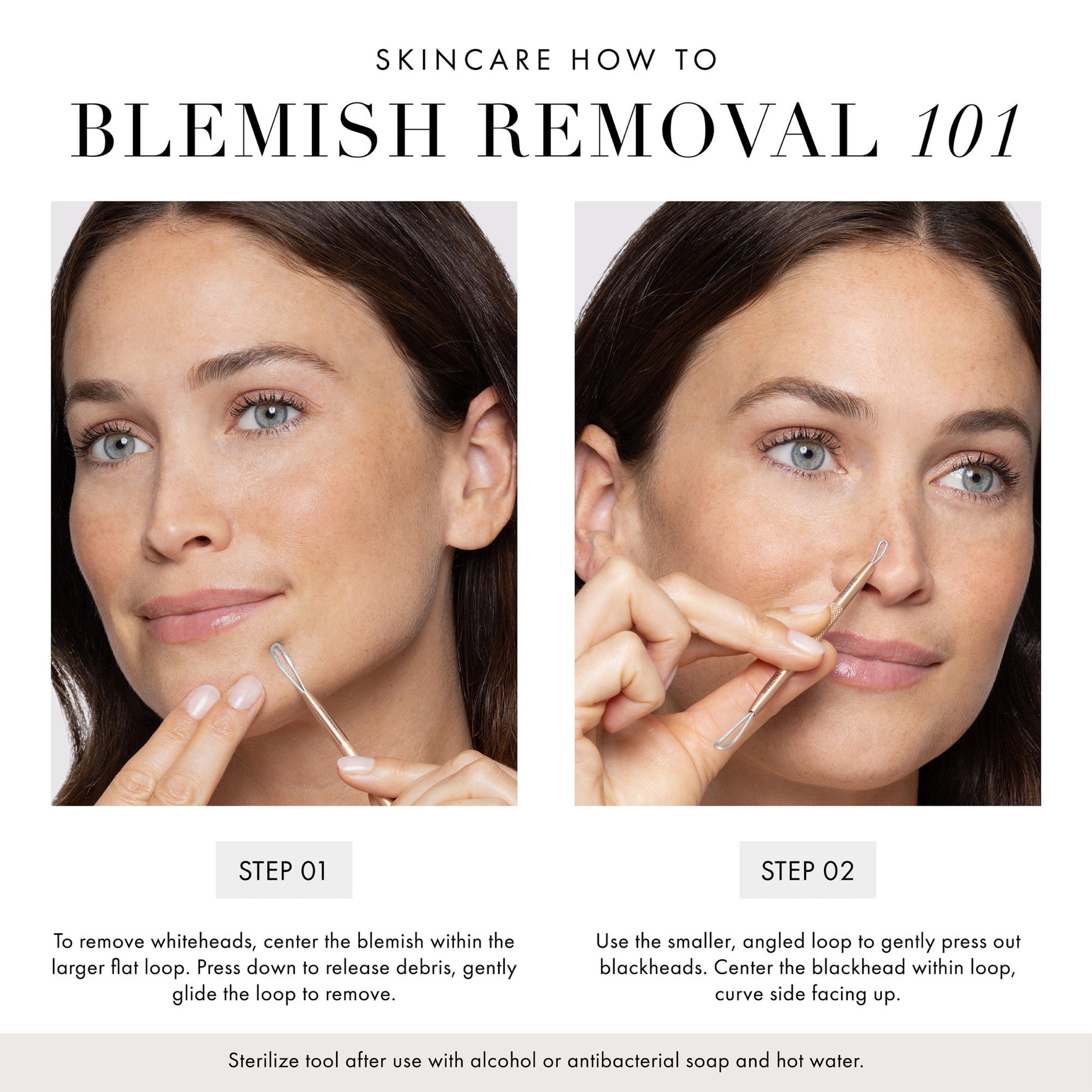 BLEMISH REMOVAL 101: STEP 1: To remove whiteheads, center the blemish within the larger flat loop. Press down to release debris, gentle glide the loop to remove. STEP 2: Use the smaller, angled loop to gently press out blackheads. Center the blackhead within the loop, curve side facing up. Sterilize tool after use with alcohol or antibacterial soap and hot water.